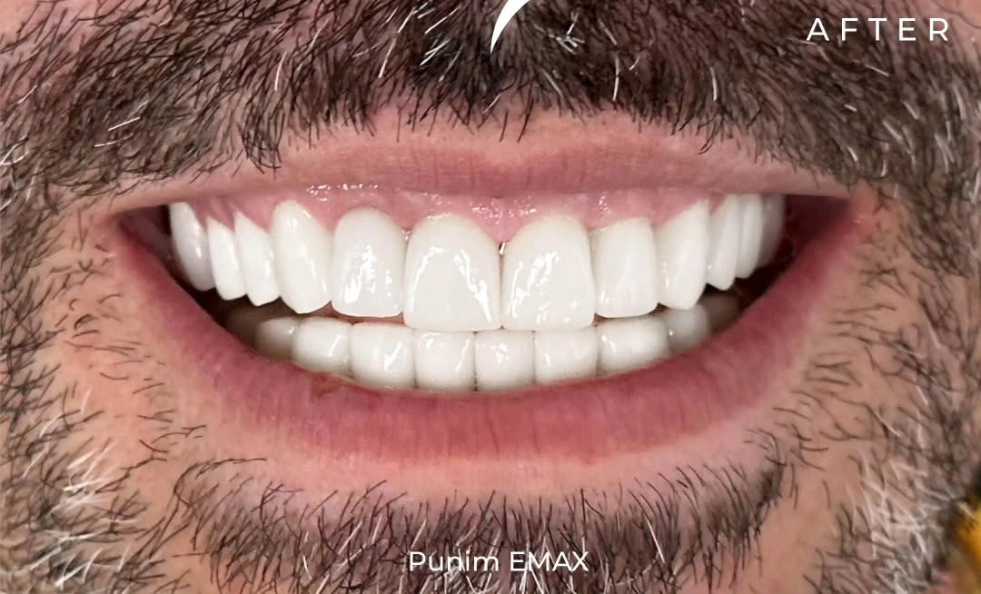 Envato labs image edit (1)