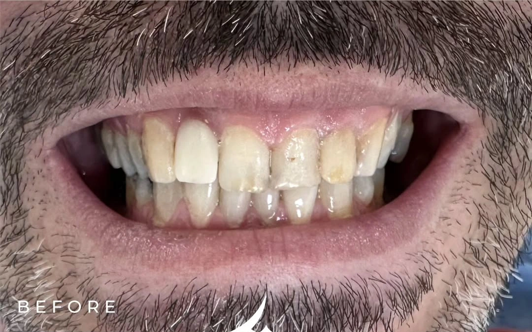 Envato labs image edit (2)