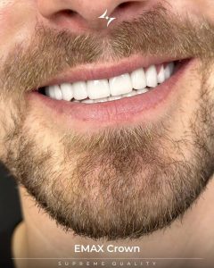 WhatsApp Image 2026 04 25 at 16.15.41